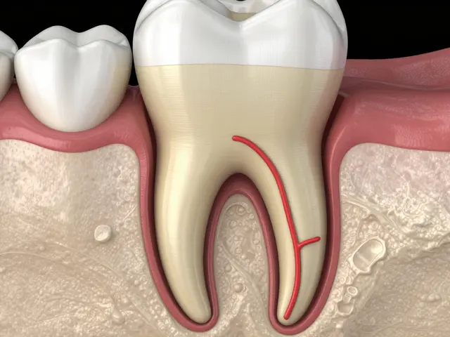 Kde je kořen zubů? Všechno, co potřebujete vědět o struktuře zubů