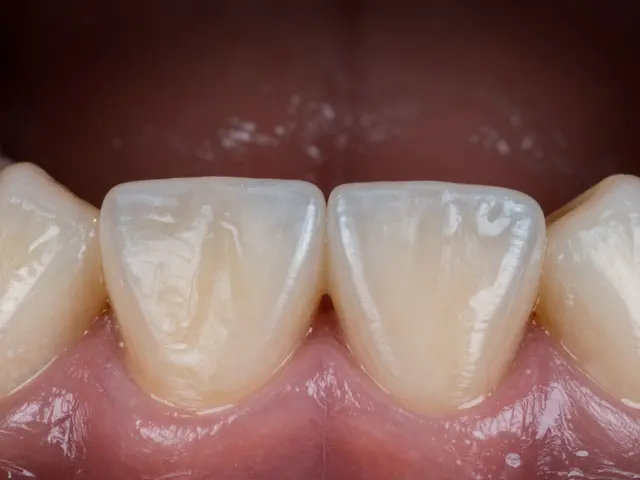 Jak opravit mezeru mezi zuby: příčiny, možnosti a co dělat hned teď