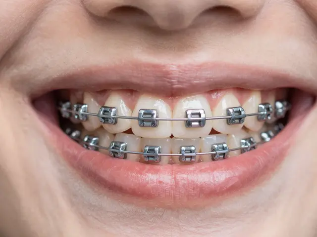 Jak se vyhnout zničeným zubům po rovnátkách: Kompletní průvodce prevencí