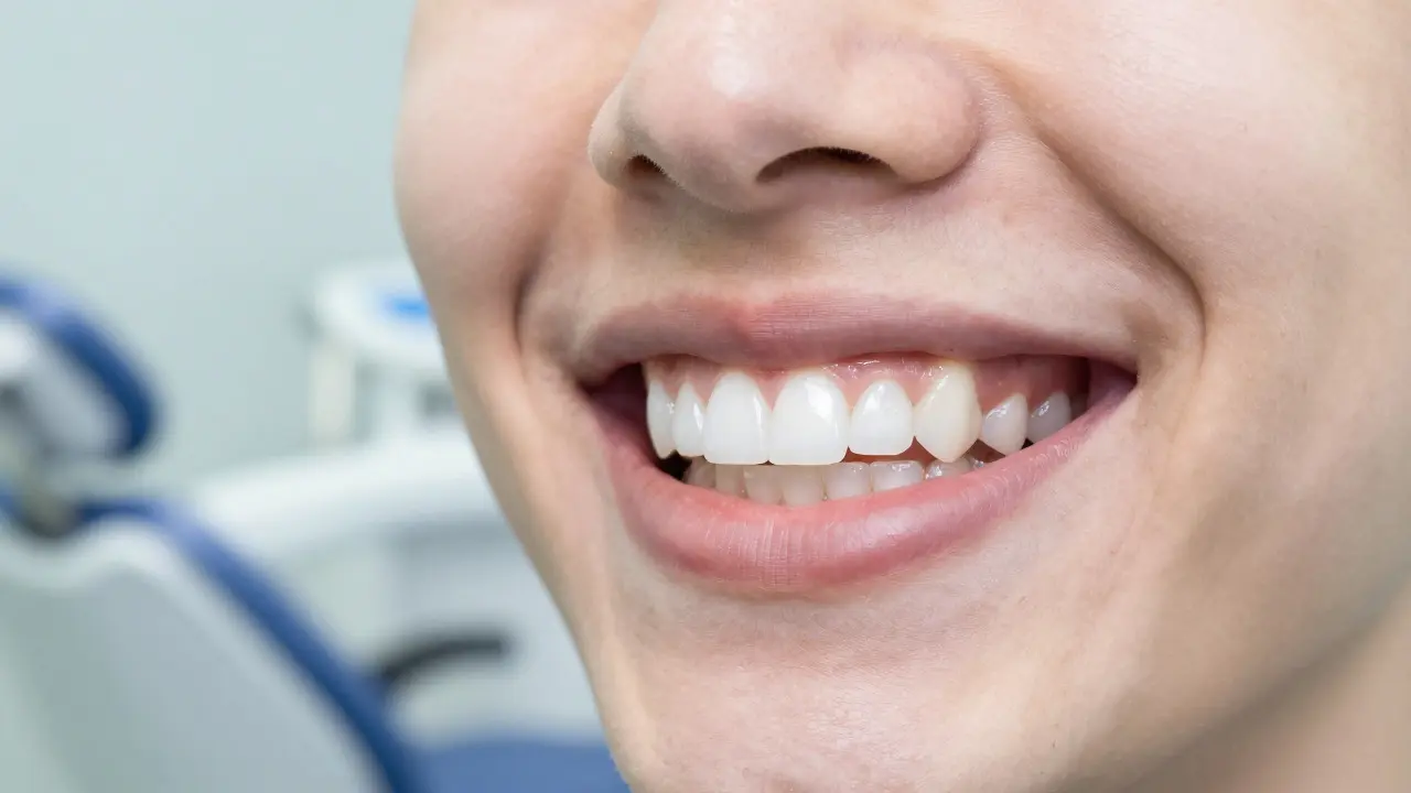 Jak dlouho držet bílou dietu po bělení zubů? Kompletní průvodce