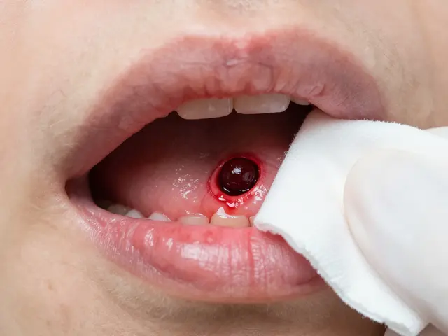 Jak má vypadat rána po vytržení zubu? Kompletní průvodce hojením a riziky